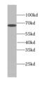 Peroxisomal Biogenesis Factor 5 Like antibody, FNab06332, FineTest, Western Blot image 