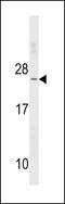 Troponin C2, Fast Skeletal Type antibody, LS-C156251, Lifespan Biosciences, Western Blot image 