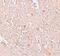 FBL16 antibody, PA5-21094, Invitrogen Antibodies, Immunohistochemistry paraffin image 