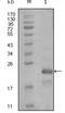 Heart And Neural Crest Derivatives Expressed 1 antibody, STJ98125, St John