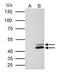 SET Nuclear Proto-Oncogene antibody, PA5-78163, Invitrogen Antibodies, Immunoprecipitation image 