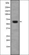 Insulin Like Growth Factor 2 MRNA Binding Protein 3 antibody, orb378122, Biorbyt, Western Blot image 