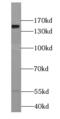 Chromatin assembly factor 1 subunit A antibody, FNab01630, FineTest, Western Blot image 