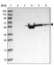 AlkB Homolog 8, TRNA Methyltransferase antibody, NBP1-81238, Novus Biologicals, Western Blot image 