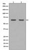 Histone Deacetylase 1 antibody, M00256, Boster Biological Technology, Western Blot image 