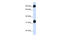 Heat Shock Protein Family A (Hsp70) Member 4 antibody, 26-101, ProSci, Western Blot image 