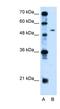 Pregnancy Specific Beta-1-Glycoprotein 1 antibody, NBP1-58001, Novus Biologicals, Western Blot image 