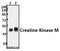 Creatine Kinase, M-Type antibody, GTX66650, GeneTex, Western Blot image 