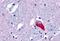 G Protein-Coupled Receptor 35 antibody, GTX70511, GeneTex, Immunohistochemistry paraffin image 