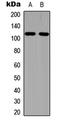 EPH Receptor A1 antibody, LS-C354361, Lifespan Biosciences, Western Blot image 