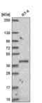 Pseudouridine Synthase 1 antibody, NBP2-56899, Novus Biologicals, Western Blot image 