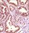 Coactivator Associated Arginine Methyltransferase 1 antibody, NB100-56374, Novus Biologicals, Immunohistochemistry paraffin image 