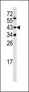 Lysine Methyltransferase 5A antibody, 62-322, ProSci, Western Blot image 