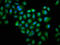 Gelsolin antibody, LS-C369738, Lifespan Biosciences, Immunofluorescence image 