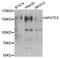 Nuclear Factor Of Activated T Cells 3 antibody, A6666, ABclonal Technology, Western Blot image 