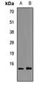 Fatty Acid Binding Protein 6 antibody, LS-C667813, Lifespan Biosciences, Western Blot image 