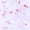 Rho Family GTPase 2 antibody, orb234954, Biorbyt, Immunohistochemistry paraffin image 