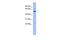 Zinc Finger CCHC-Type And RNA Binding Motif Containing 1 antibody, PA5-41924, Invitrogen Antibodies, Western Blot image 