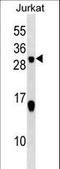 Stathmin 2 antibody, LS-C161571, Lifespan Biosciences, Western Blot image 