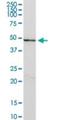 Cylicin 2 antibody, H00001539-B01P, Novus Biologicals, Western Blot image 