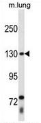 Thyroid Hormone Receptor Associated Protein 3 antibody, AP54243PU-N, Origene, Western Blot image 