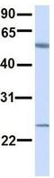 ALG6 Alpha-1,3-Glucosyltransferase antibody, GTX46386, GeneTex, Western Blot image 