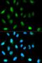 Chromobox 5 antibody, LS-C331259, Lifespan Biosciences, Immunofluorescence image 