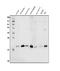 Stathmin 1 antibody, PB9560, Boster Biological Technology, Western Blot image 