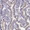 Myosin IA antibody, NBP2-55431, Novus Biologicals, Immunohistochemistry paraffin image 