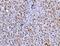 Fas Associated Via Death Domain antibody, A00237-4, Boster Biological Technology, Immunohistochemistry paraffin image 