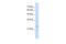 Protein Tyrosine Phosphatase Non-Receptor Type 2 antibody, PA5-42722, Invitrogen Antibodies, Western Blot image 