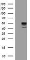 Collagenase 3 antibody, TA506689S, Origene, Western Blot image 