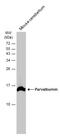 Parvalbumin antibody, GTX134127, GeneTex, Western Blot image 