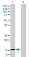 Tetratricopeptide Repeat Domain 32 antibody, H00130502-B01P, Novus Biologicals, Western Blot image 