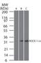 Rho Associated Coiled-Coil Containing Protein Kinase 1 antibody, MA1-41031, Invitrogen Antibodies, Western Blot image 