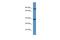 Olfactory Receptor Family 2 Subfamily M Member 5 antibody, A17540, Boster Biological Technology, Western Blot image 