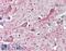 Aldehyde Dehydrogenase 5 Family Member A1 antibody, 42-677, ProSci, Enzyme Linked Immunosorbent Assay image 
