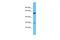 Transmembrane Serine Protease 11E antibody, A11488, Boster Biological Technology, Western Blot image 