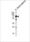 Hemopexin antibody, 62-383, ProSci, Western Blot image 