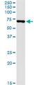 USH1 Protein Network Component Harmonin antibody, MA5-20917, Invitrogen Antibodies, Immunoprecipitation image 