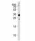 Ribosomal Protein S6 antibody, F47555-0.4ML, NSJ Bioreagents, Western Blot image 