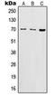 Interleukin 2 Receptor Subunit Beta antibody, LS-C352355, Lifespan Biosciences, Western Blot image 