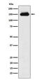 Timeless Circadian Regulator antibody, M00831, Boster Biological Technology, Western Blot image 