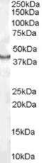 Caudal Type Homeobox 2 antibody, EB07190, Everest Biotech, Western Blot image 