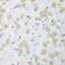 Protein Disulfide Isomerase Family A Member 3 antibody, GTX32592, GeneTex, Immunohistochemistry paraffin image 