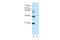 Spliceosome Associated Factor 3, U4/U6 Recycling Protein antibody, 29-012, ProSci, Western Blot image 