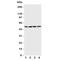 BCL2 Associated Athanogene 5 antibody, R31213, NSJ Bioreagents, Western Blot image 