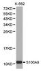 S100 Calcium Binding Protein A8 antibody, LS-C192895, Lifespan Biosciences, Western Blot image 