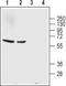 GAT-1 antibody, TA328856, Origene, Western Blot image 