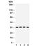 Potassium Voltage-Gated Channel Interacting Protein 2 antibody, R32335, NSJ Bioreagents, Western Blot image 